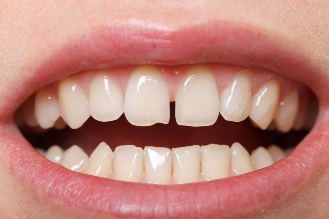 gel helps teeth grow back